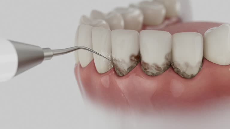Trusted Wisdom Tooth Removal service in Valley View, PA - Dentist Open Now